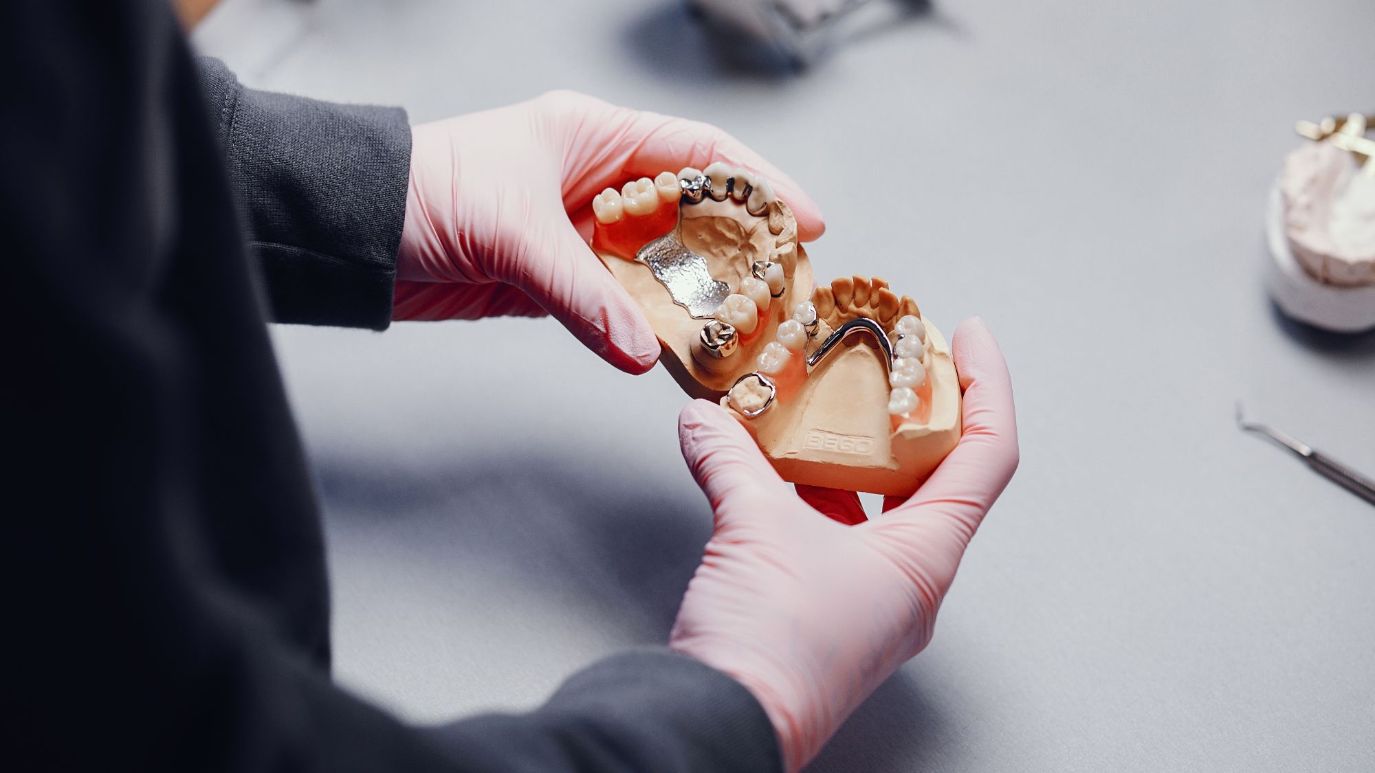 A dentist is holding a denture, comparing full dentures and partial dentures