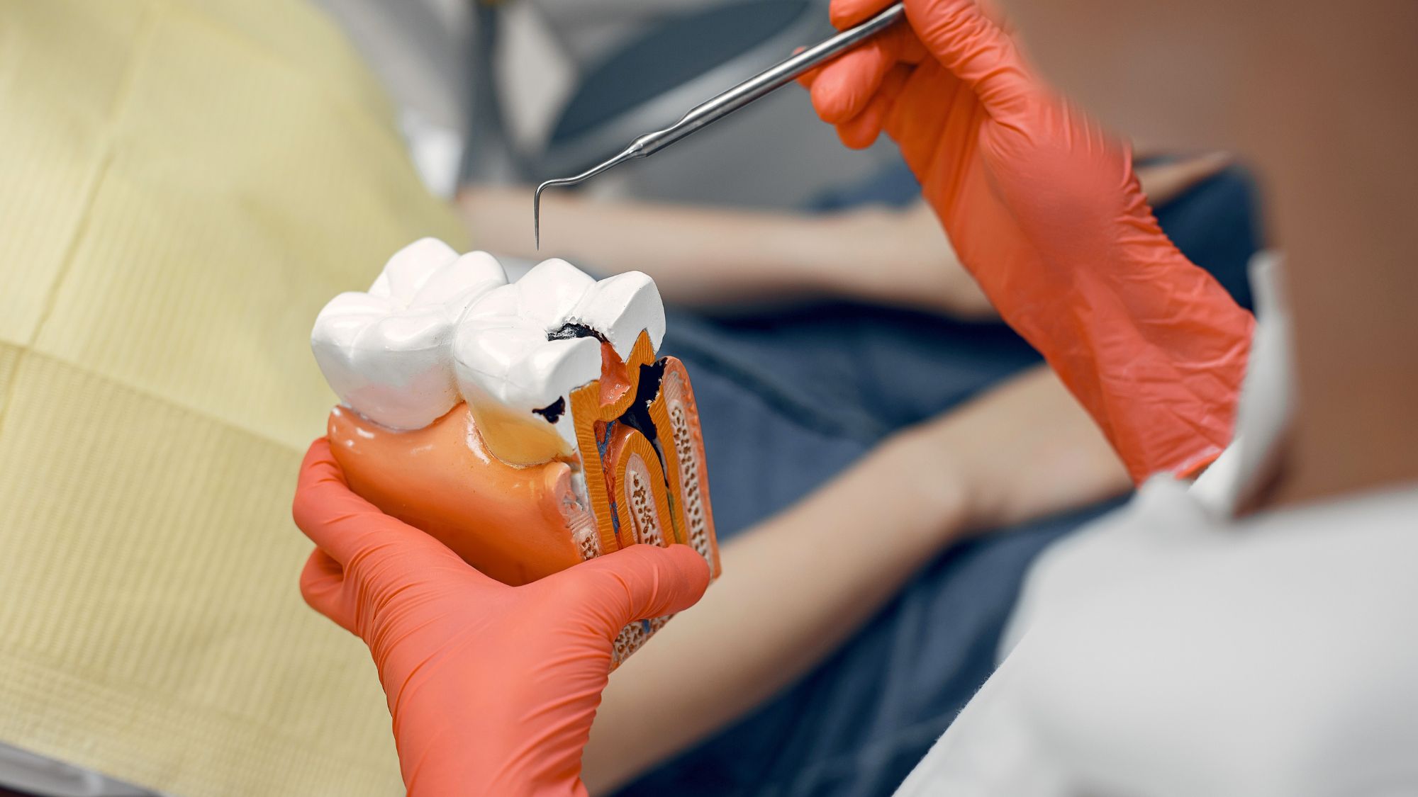A doctor is guiding a patient about root canal recovery time with a tooth model in her hand