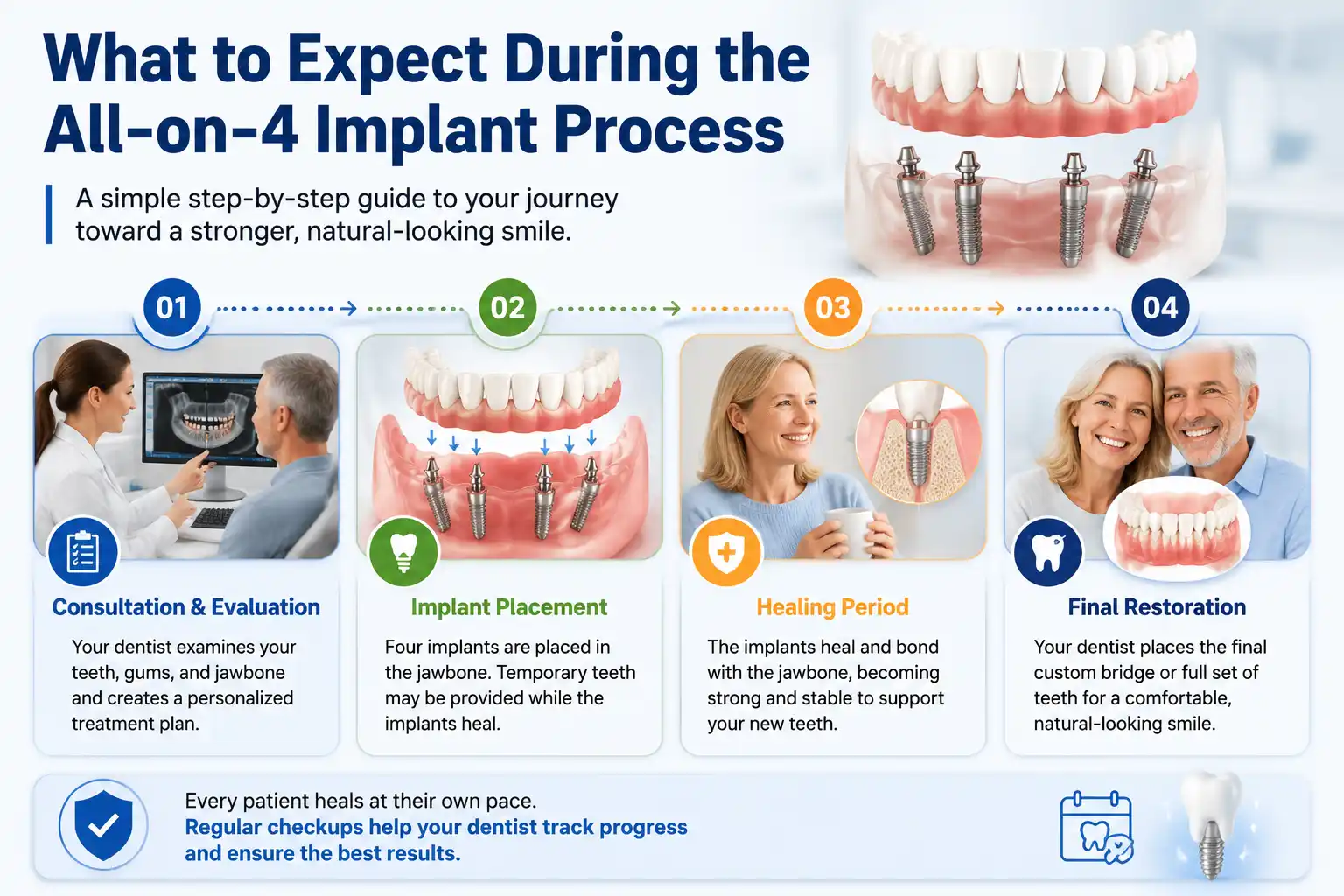 Infographic explaining the All-on-4 dental implant process, including consultation and evaluation, implant placement, healing period, and final restoration with custom implant-supported teeth.