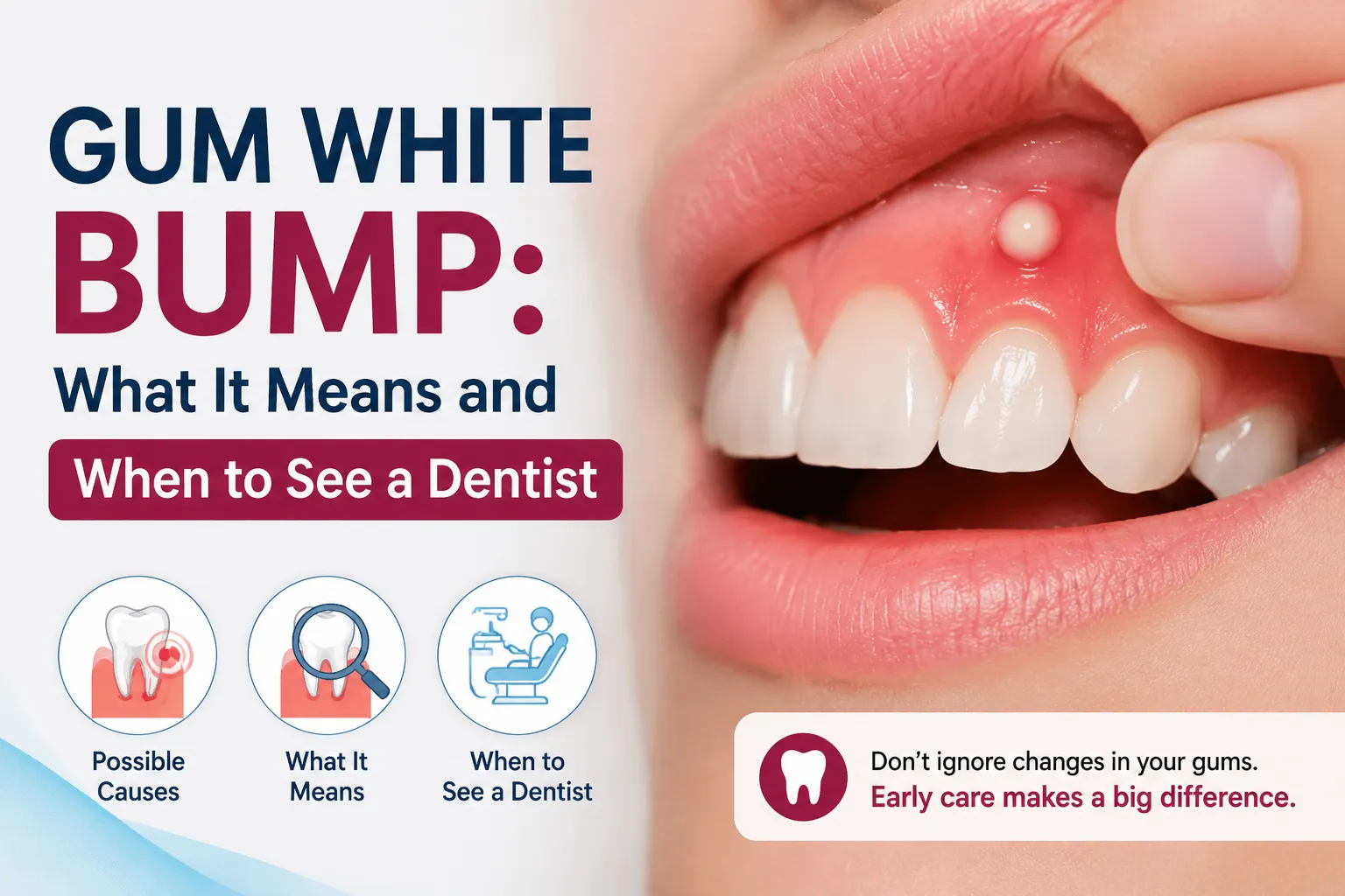 Featured image showing a white bump on gum with dental guidance about causes, symptoms, and when to see a dentist
