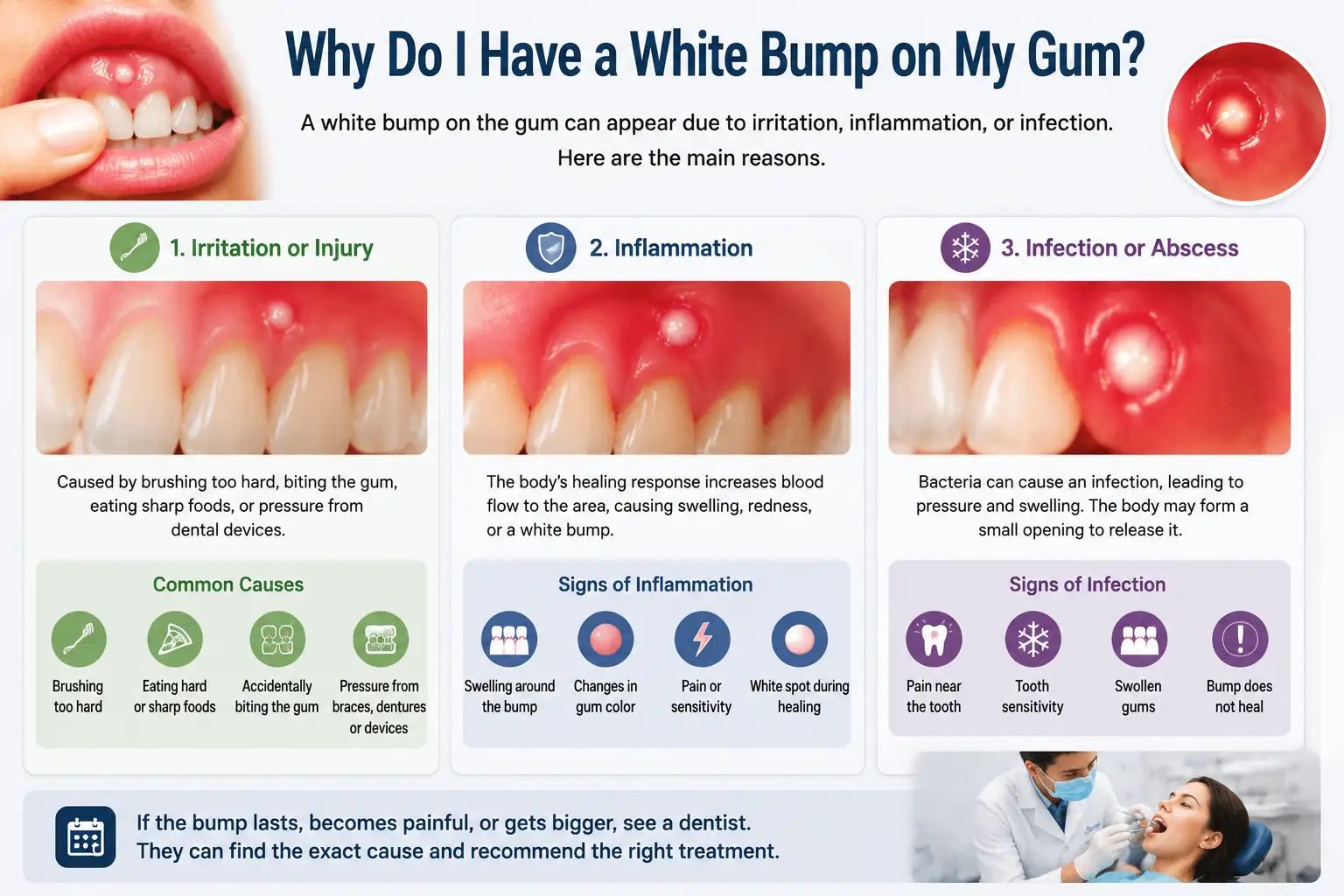 Dental infographic explaining why a white bump appears on the gum due to irritation, inflammation, or infection near a tooth