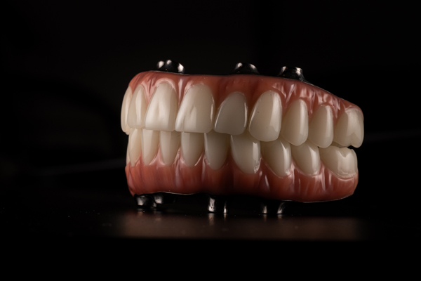 Implant Supported Dentures FAQs